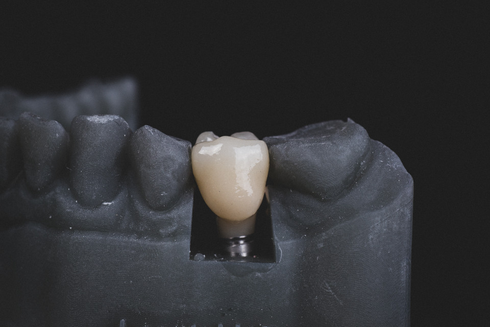 New Dental Implant Crowns Made of Cellulose-Based Nanocomposites