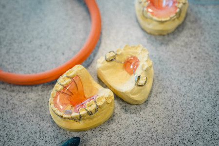 Dental Prosthetics