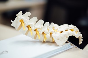 spine implant 